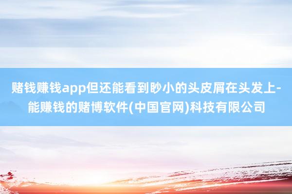 赌钱赚钱app但还能看到眇小的头皮屑在头发上-能赚钱的赌博软件(中国官网)科技有限公司